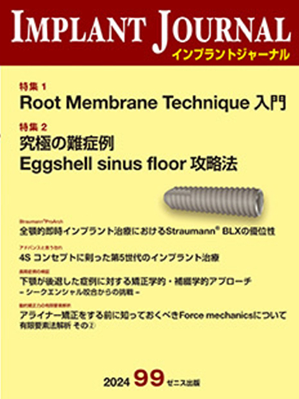 Root Membrane Technique入門 IMPLANT JOURNAL99号